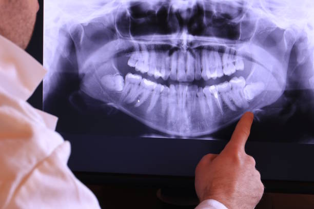 Best Emergency Dentist for Knocked-Out Tooth in Monroeville, IN
