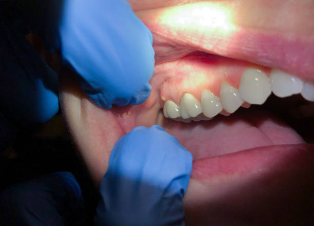 Best Emergency Dentist for Special Needs Patients in Monroeville, IN